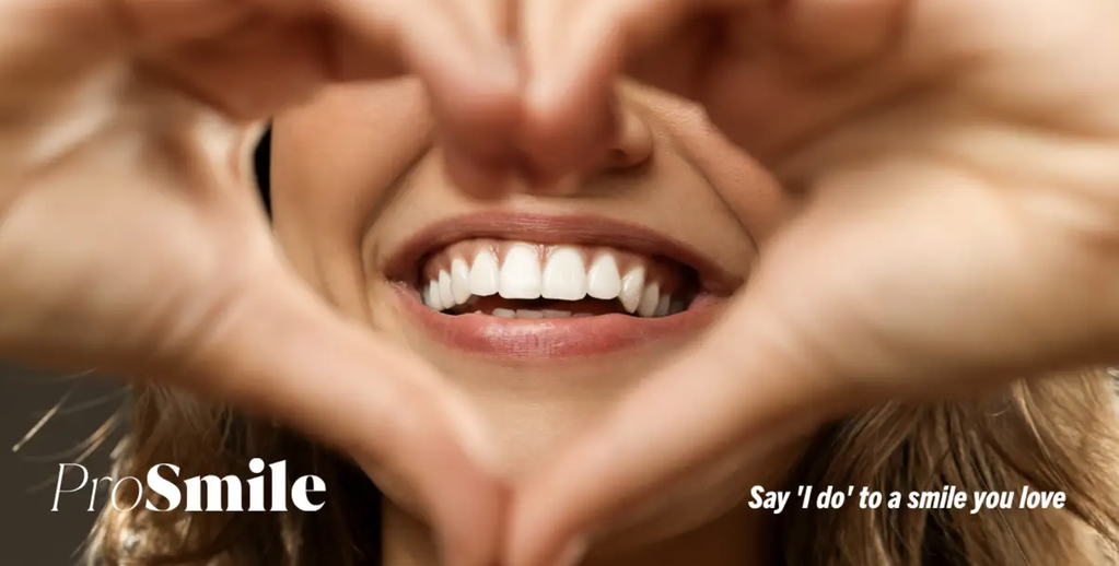 How to Plan Your Wedding Smile: Whitening, Straightening and Confidence for the Big Day